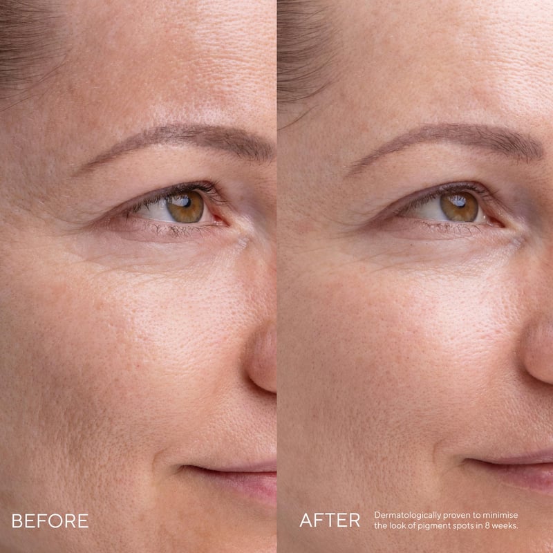 MADARA Kojic Alternative Pigment Serum afbeelding